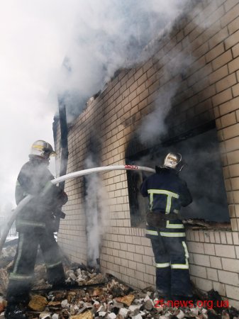 На Житомирщині внаслідок пожежі 11-річний хлопчик отримав 70% опіків тіла