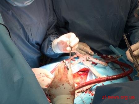 В кардіохірургічному центрі вперше в Житомирській області проведено операцію на відкритому серці