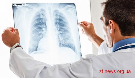 На Житомирщині лікарі констатують зростання захворюваності на туберкульоз