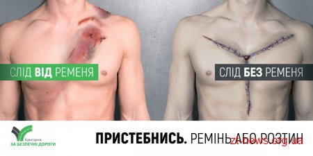 У Житомирі у рамках інформаційної кампанії “Ремінь або розтин” розмістили  шокуючу соціальну рекламу