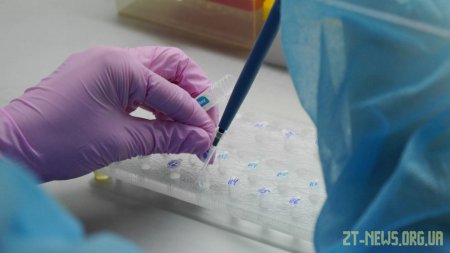 Нових лабораторно підтверджених випадків COVID-19 на Житомирщині немає