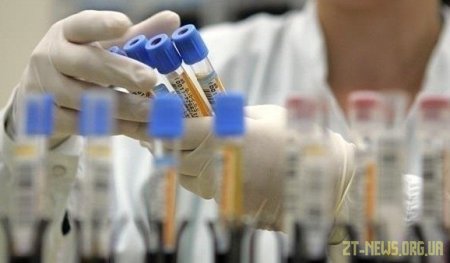 За минулу добу на Житомирщині підтвердили 53 нові випадки захворювання на коронавірус